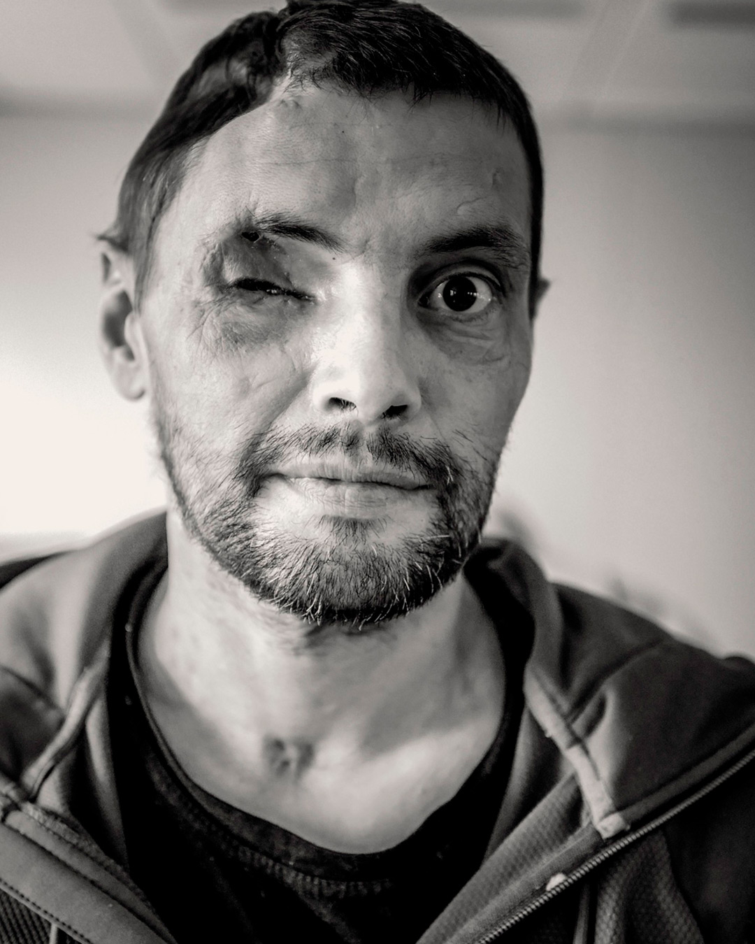 Jean-Michel BECOGNÉE